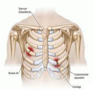 Triệu chứng đau ngực phải