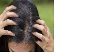 Nguyên nhân tóc bạc sớm ở nữ